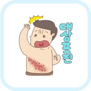 대상포진 증상