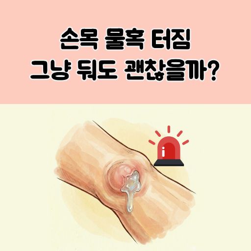 손목 물혹 터짐 썸네일 이미지